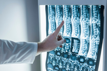 Neurologist and surgeon examine a patient's spine image - Powered by Adobe
