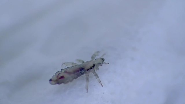 Kopflaus (Pediculus humanus capitis) head louse