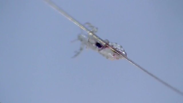 Kopflaus (Pediculus humanus capitis) head louse