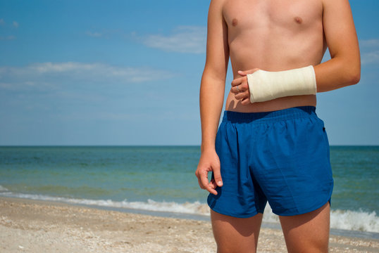 Gypsum fracture on a man's hand, sand close-up against the background of the sea and the sky clouds, broken arm limb, illness recovery, the guy in blue shorts, summer sun weekend rest vacation, beach 