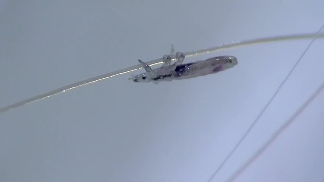 Kopflaus (Pediculus humanus capitis) head louse