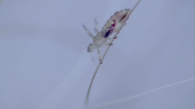 Kopflaus (Pediculus humanus capitis) head louse