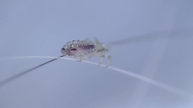 Kopflaus (Pediculus humanus capitis) head louse