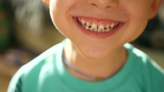 A small child shows emotions: laughter, happiness, joy, smile. Close-up of a child's mouth. A child demonstrates teeth.