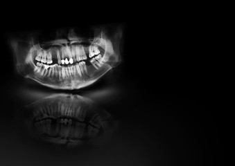 Panoramic radiograph is a scanning dental X-ray of the upper jaw maxilla and lower jawbone mandible. Black background with with glow, shadow and reflection. Medical horizontal design template for text