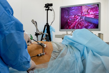 A team of surgeons using endo-instruments operate the patient's abdomen. Endoscopy. Surgery on the...