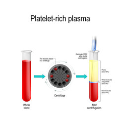 Platelet-rich plasma. - obrazy, fototapety, plakaty