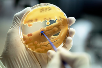 Klebsiella pneumoniae colonies; Close up the media plate on hand medical technicians working on...