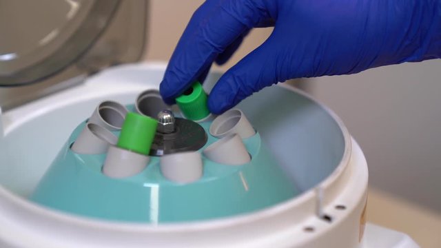 The doctor inserts a blood tube into the centrifuge and turns it on