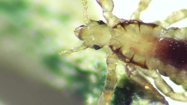 Kopflaus (Pediculus humanus capitis), head lice