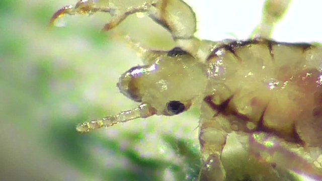 Kopflaus (Pediculus humanus capitis), head lice