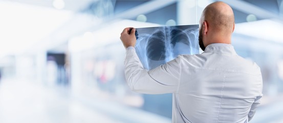 Portrait of young doctor man holding x-ray of human breast