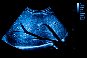 Colourful image of modern ultrasound monitor