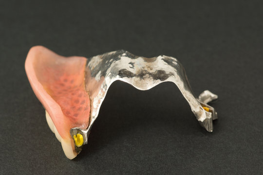 large image of a modern arc denture with attachmens