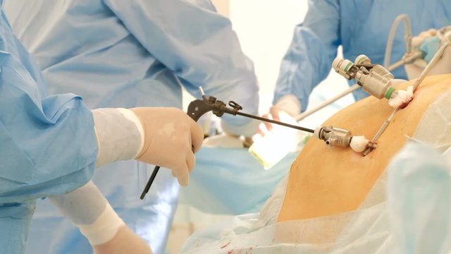 Washing of endoscopic laparoscopy medical equipment. Close-up of doctors hands during abdominal surgery of a fat man or a pregnant woman. A team of surgeons at work. Endoscopy. Endovideosurgery.