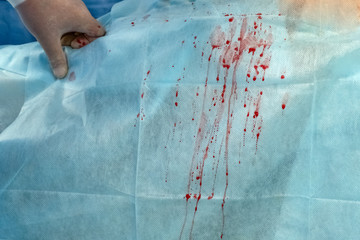 Bloody drops and stains in the operating room of the hospital. Hand of a surgeon in a white glove. Blue medical background. Copy space.