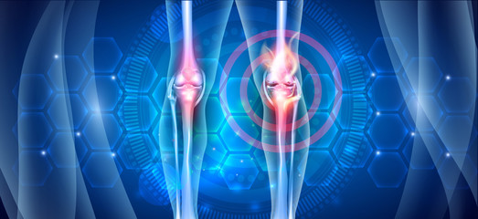 Joint knee problems diagram on an abstract blue scientific background with abstract fire, joint ache concept - obrazy, fototapety, plakaty
