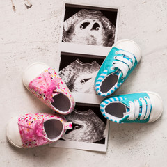Blue and pink booties next to baby photos with ultrasound in 4th week of pregnancy. Waiting for twins. Son and daughter. Selective focus.