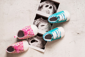 Blue and pink booties next to baby photos with ultrasound in 4th week of pregnancy. Waiting for twins. Son and daughter. Selective focus.