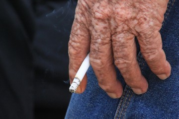 Manos de anciano
