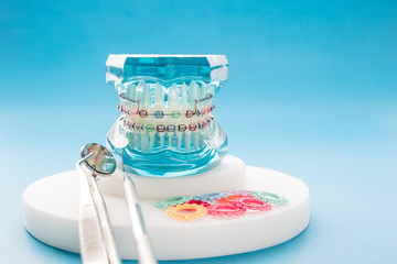orthodontic model and dentist tool - demonstration teeth model of varities of orthodontic bracket...