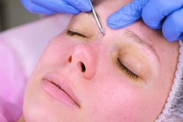 Mechanical cleaning of the face at the beautician. Cosmetologist squeeze the acne on the face of the patient medical needle.