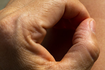 Fototapeta premium Woman's dry skin on thumb of hand, Close up & Macro shot, Asian Body skin part, Healthcare concept, Abstract background