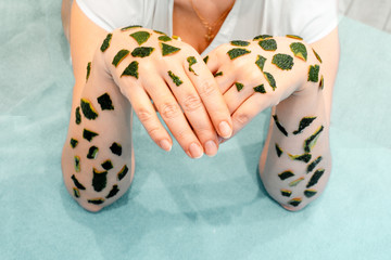 Skin beriberi, allergic reactions, the appearance of crusts on the skin reaction the concept of...