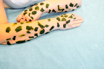 Skin beriberi, allergic reactions, the appearance of crusts on the skin reaction the concept of...