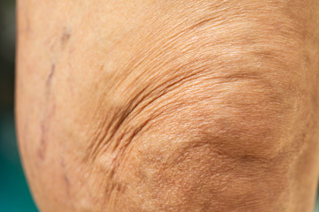 Senior woman's wrinkled knees in blue swimming pool, Blurred and bokeh background, Close up & Macro shot, Selective focus, Body concept