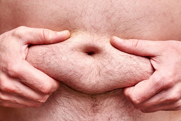 Male hands hold subcutaneous fat on the hairy belly.