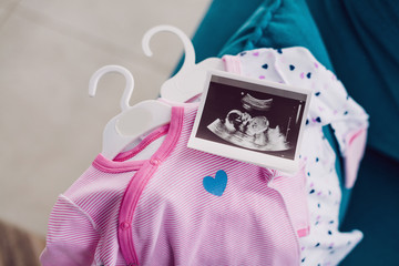 Two pink children rompers with ultrasound picture of 20 weeks baby