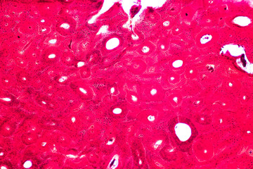 Concept of Education anatomy and physiology of Compact bone, or cortical bone under the microscopic...
