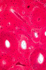 Concept of Education anatomy and physiology of Compact bone, or cortical bone under the microscopic in laboratory.