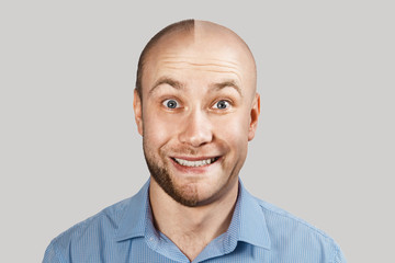 Obraz premium happy Man before and after hair loss, alopecia on background