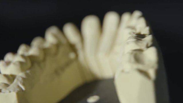Dental Mold being Scanned for 3D software.