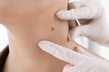 Dermatologist examining patient in clinic, closeup view