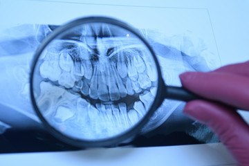 Dental x-ray with a magnifying glass