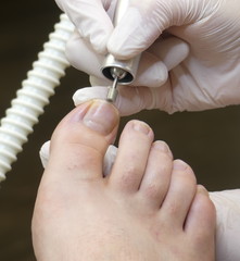 Podiatrist, Podiatry, Podologie, Podologe, Chiropodist, Fusspflege