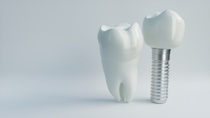 Tooth human implant - 3D Rendering - obrazy, fototapety, plakaty
