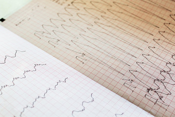 Close up view of an electrocardiogram paper.