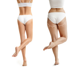 Two young thick and thin women have different figures. Comparison concept. Slim and fat girls. Fat...