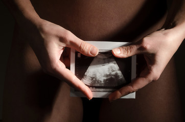 Ultrasonic photo in the hands of a naked girl.