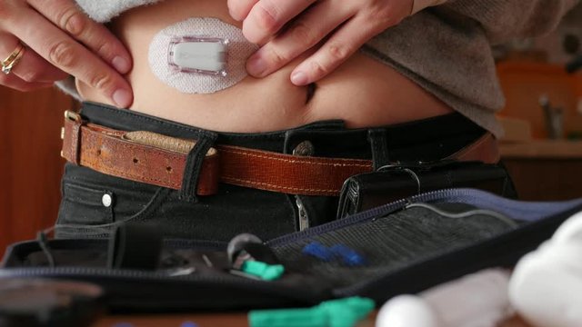 showing attached dexcom transmitter, real-time glucose reading