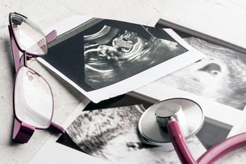 Phonendoscope vs stethoscope and glasses lie on ultrasound images of the embryo at 4 and 20 weeks...