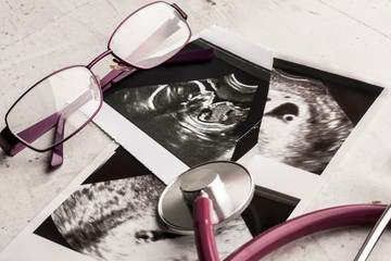 Phonendoscope vs stethoscope and glasses lie on ultrasound images of the embryo at 4 and 20 weeks...