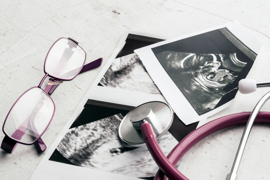 Phonendoscope vs stethoscope and glasses lie on ultrasound images of the embryo at 4 and 20 weeks of gestation. IVF in vitro fertilization concept. Observation. Selective focus.