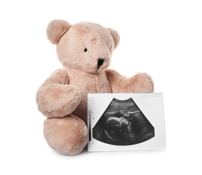 Ultrasound photo of baby and toy teddy bear on white background. Concept of pregnancy