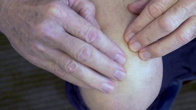 Closeup-Aging hands massage painful scar from knee replacement surgery-POV