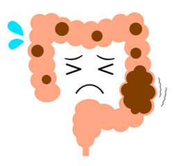 便秘に苦しむ大腸